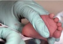 Nguyên tắc sàng lọc sơ sinh và kỹ thuật lấy máu gót chân