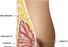 Các phương pháp chẩn đoán ung thư vú