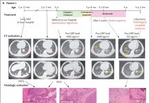 Tạp chí The New England Journal of Medicine số mới “Lây truyền ung thư qua âm đạo từ mẹ mắc ưng thư cổ tử cung sang trẻ sơ sinh”