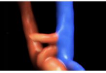 Siêu âm Sản Phụ khoa thế giới ( ISUOG) Số tháng 6