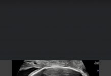 Khoá học trực tuyến với chủ đề về siêu âm học thần kinh