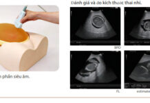 ĐÀO TẠO TRÊN MÔ HÌNH SIÊU ÂM SẢN PHỤ KHOA