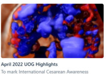 Siêu âm Sản Phụ Khoa Thế giới (ISUOG)