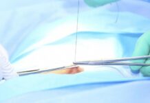 Phục hồi lại vết cắt tầng sinh môn và vết rách sàn chậu trong sản khoa (từ độ một đến độ bốn)